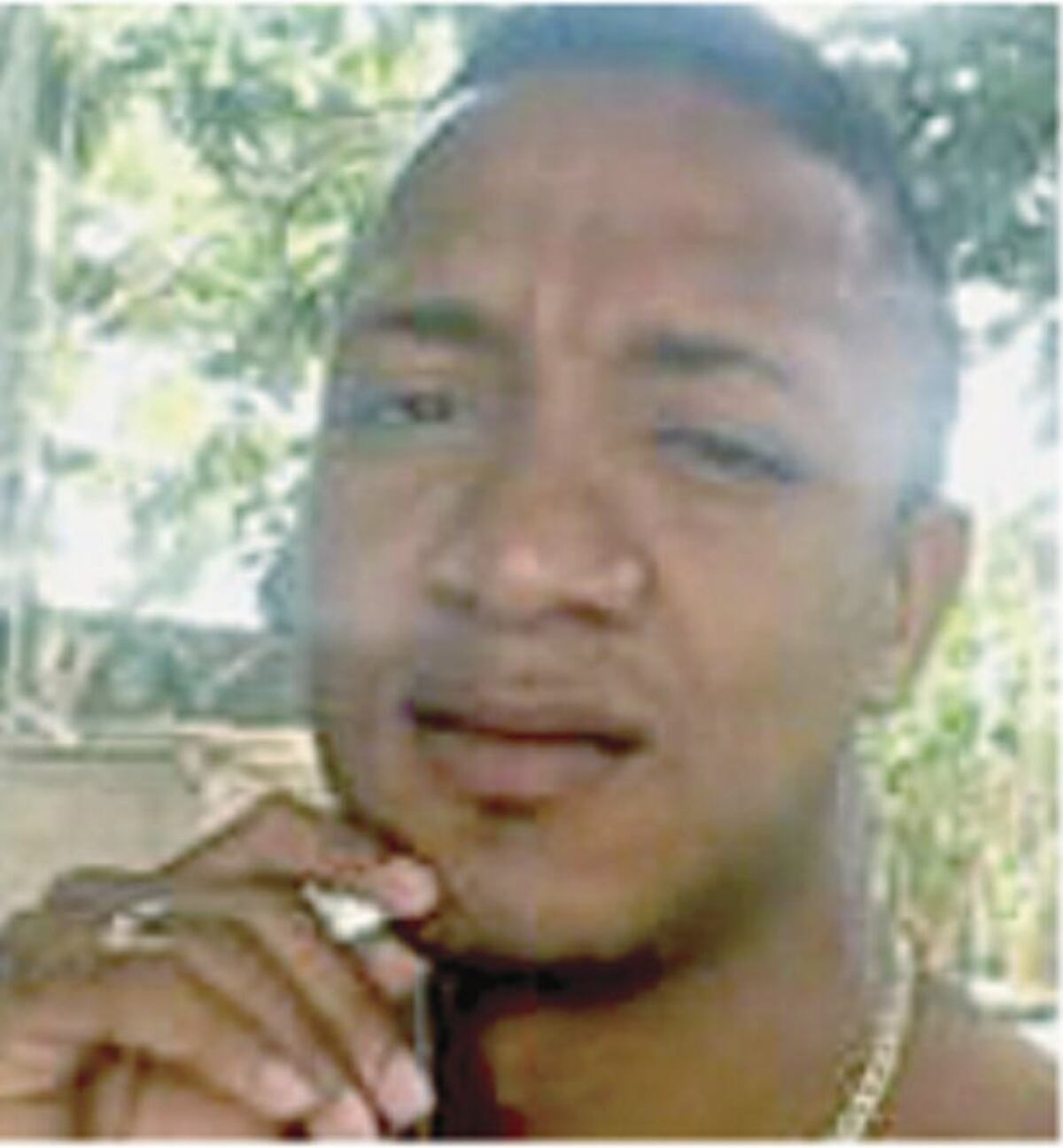 Este hombre estaba con dos mujeres en Pedregal y le dieron bala +FOTO