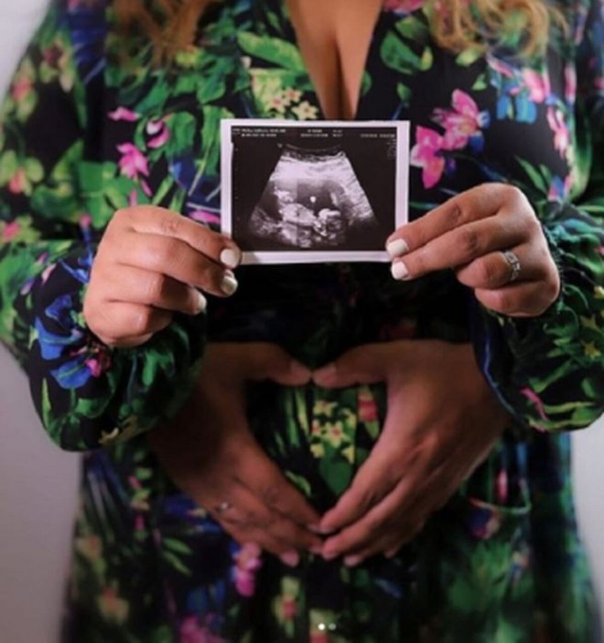 Presentadora de TV Kathy Phillips está embarazada. Asegura que 'es un milagro'