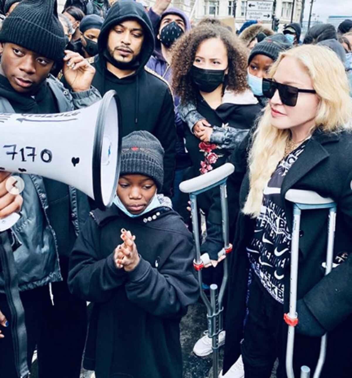 Ni las muletas detuvieron a la reina. Madonna también salió a la calle a decirle no al racismo