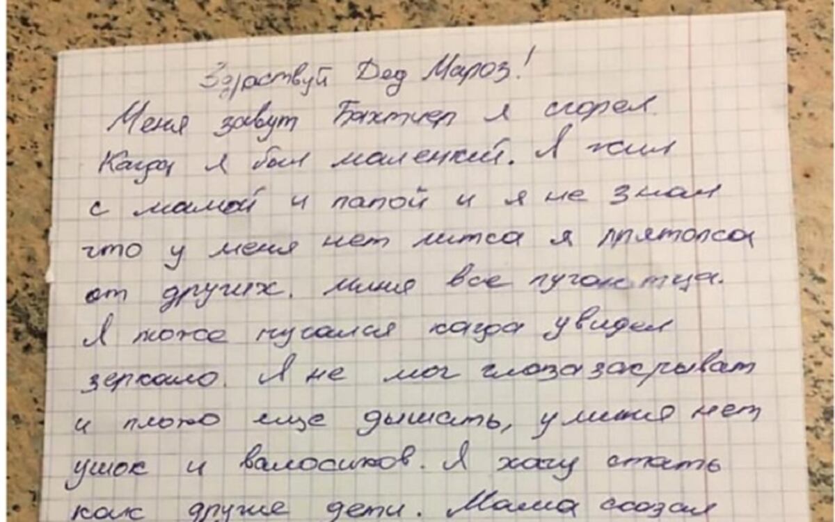 Pide en una carta que le regalen un rostro nuevo para no asustar a las personas