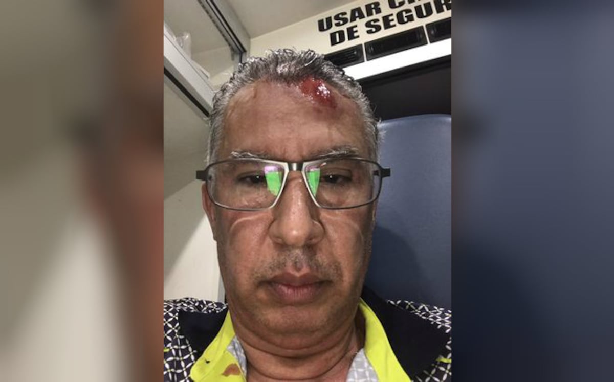 ¡SANTO! Director del Seguro Social se accidenta en la Transístmica | FOTOS