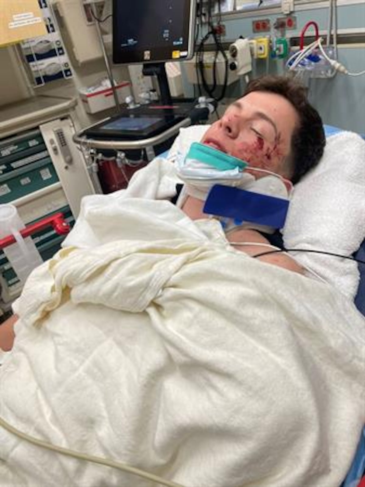 Cantante Guaynaa sufre fuerte accidente