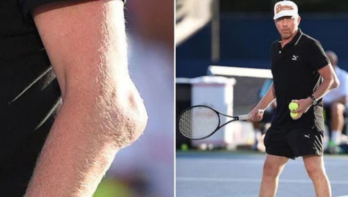 En Alemania se vuelve tendencia el extraño bulto del extenista Boris Becker