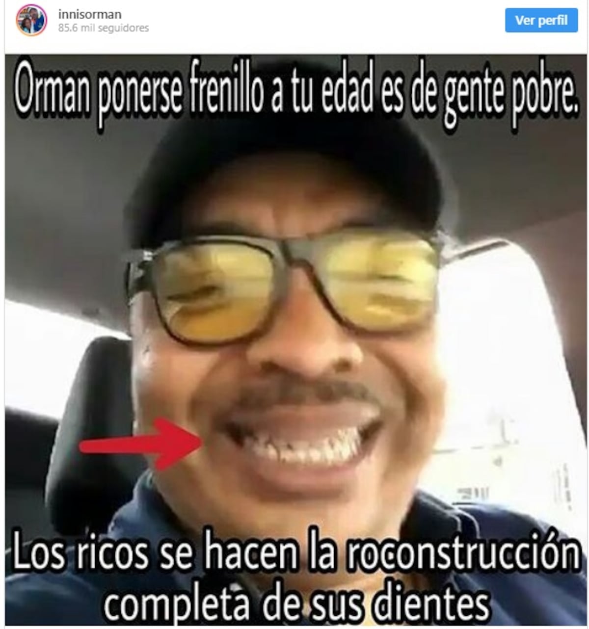 Orman Innis se quema y dice que son ‘cosas de pobres’