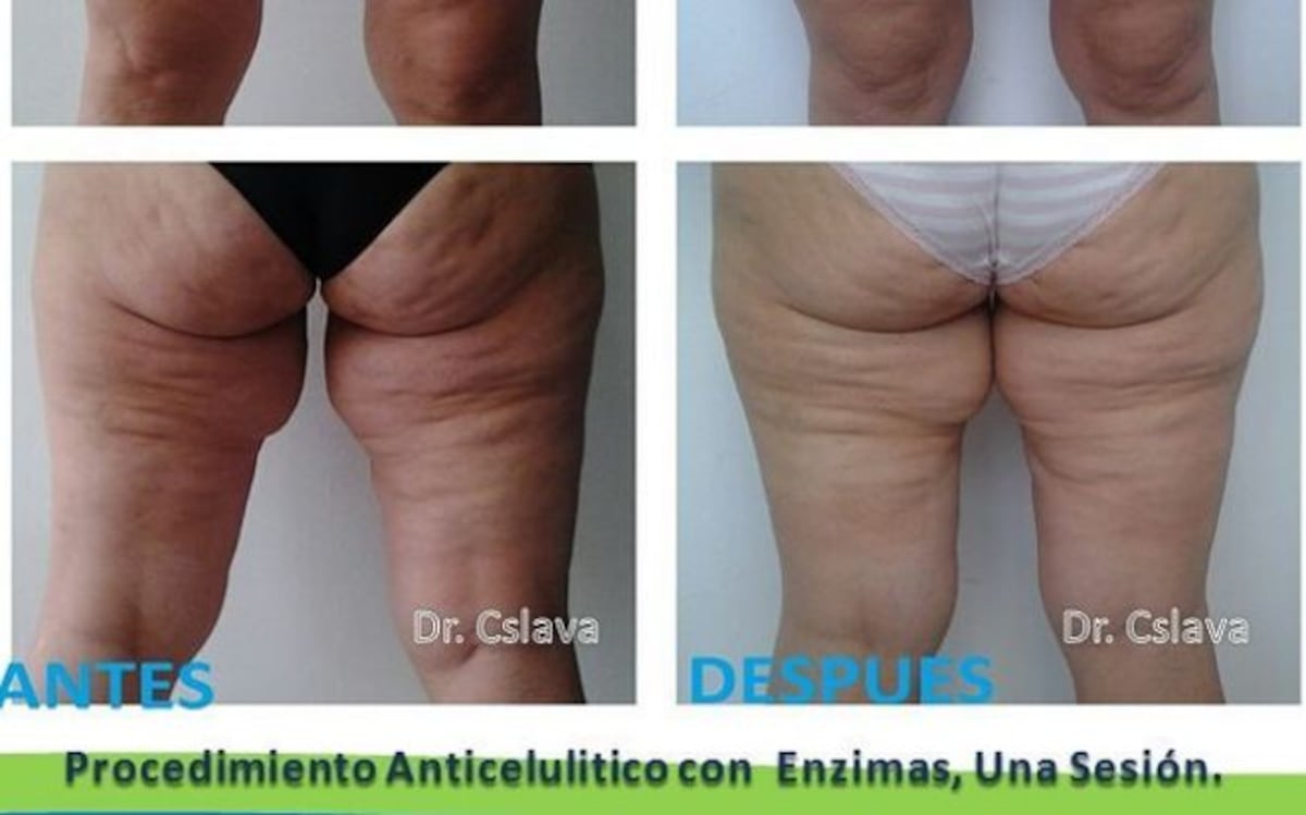 ¡SANTO!Descubre todo lo que hacía el supuesto médico en su clínica en Vía Brasil