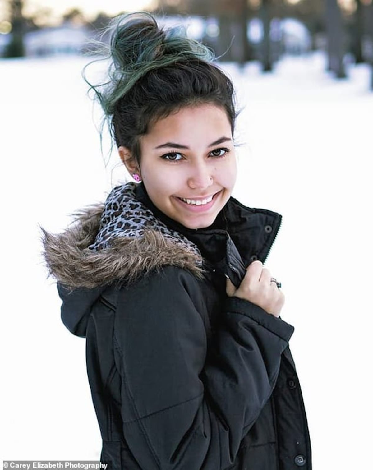 ¡De terror! Tiburón arranca la pierna a una joven que disfrutaba en playa de Estados Unidos