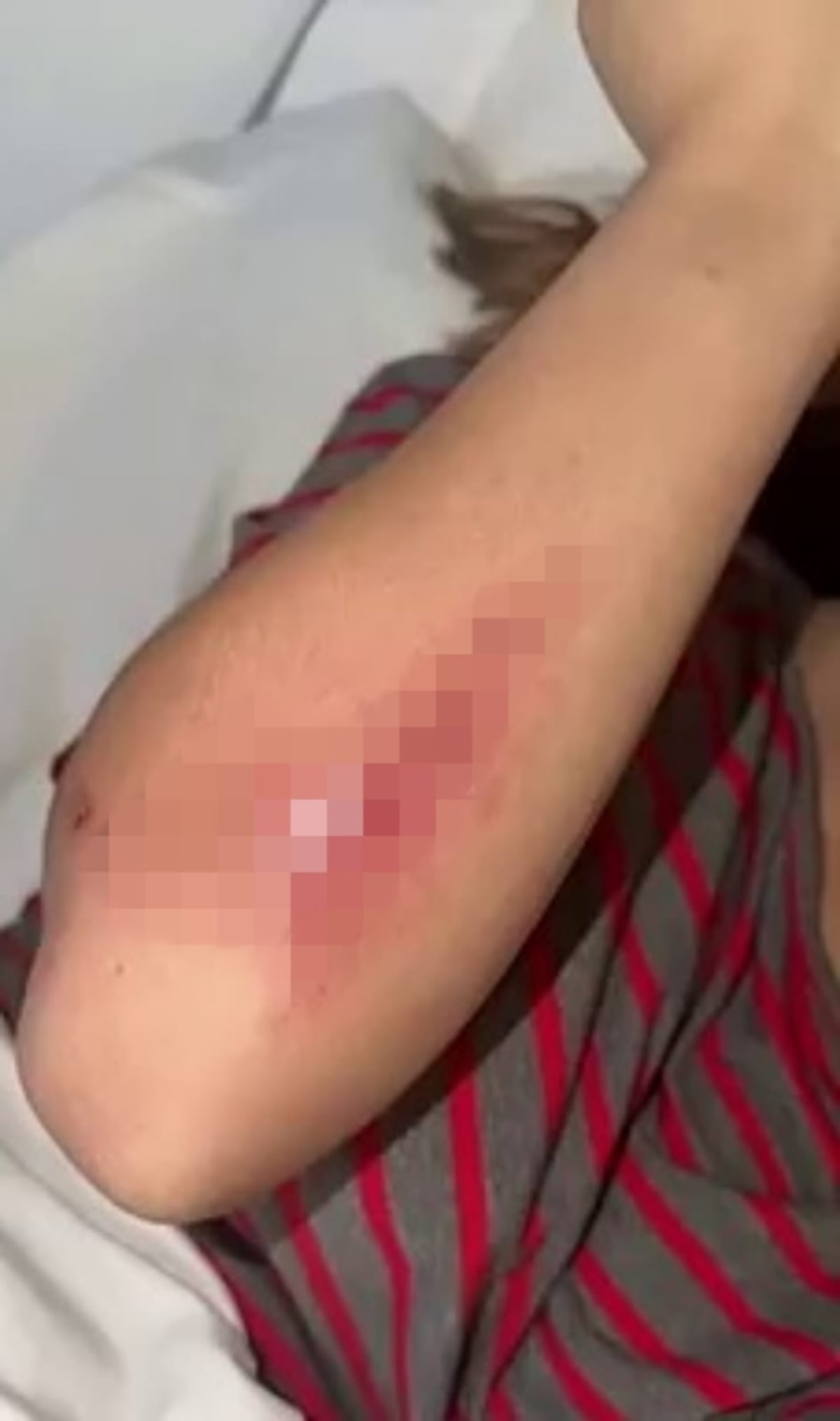 ‘Me hice pelota’: Susy Mouriz sufre fuerte accidente de scooter tras esquivar a un niño