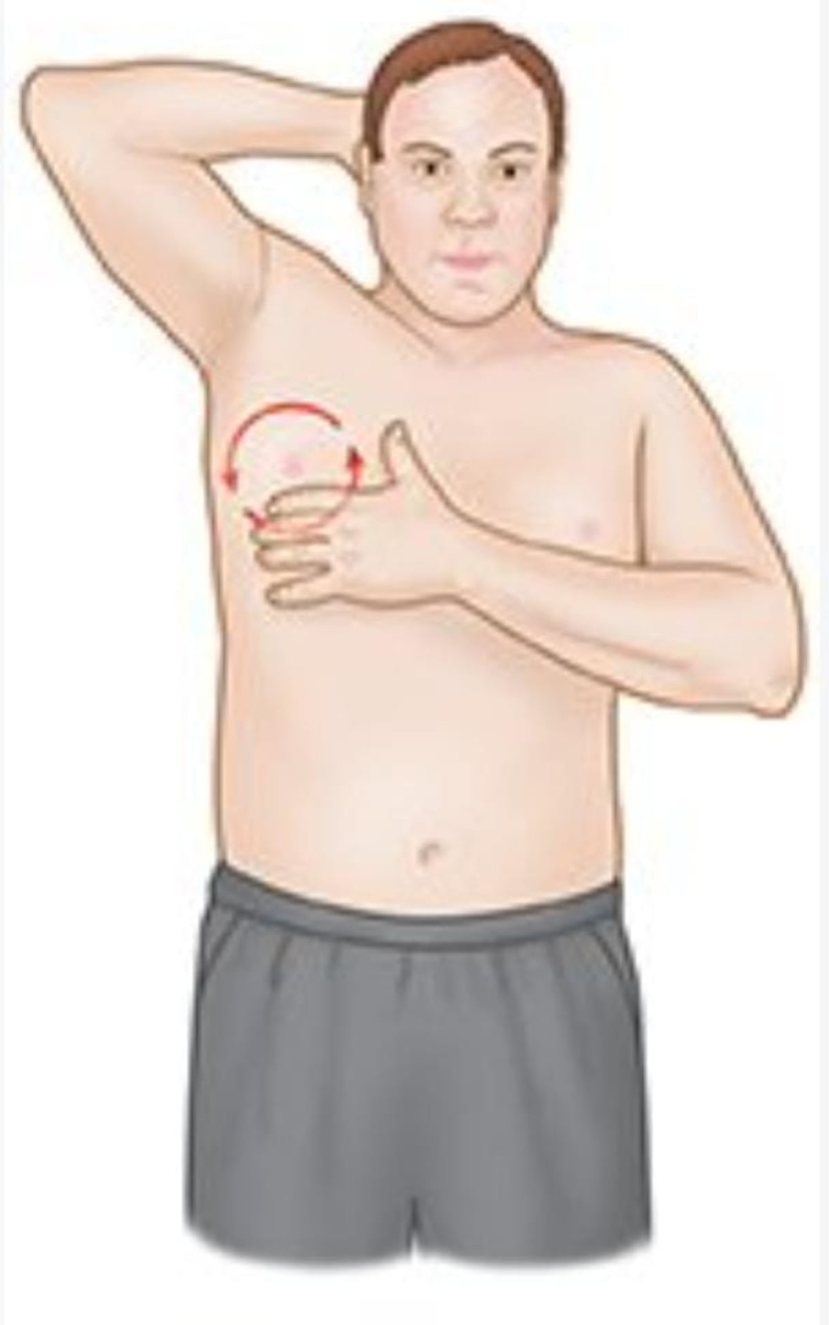 ¡ATENTOS HOMBRES! 64 casos de cáncer de mama registrados en cinco años