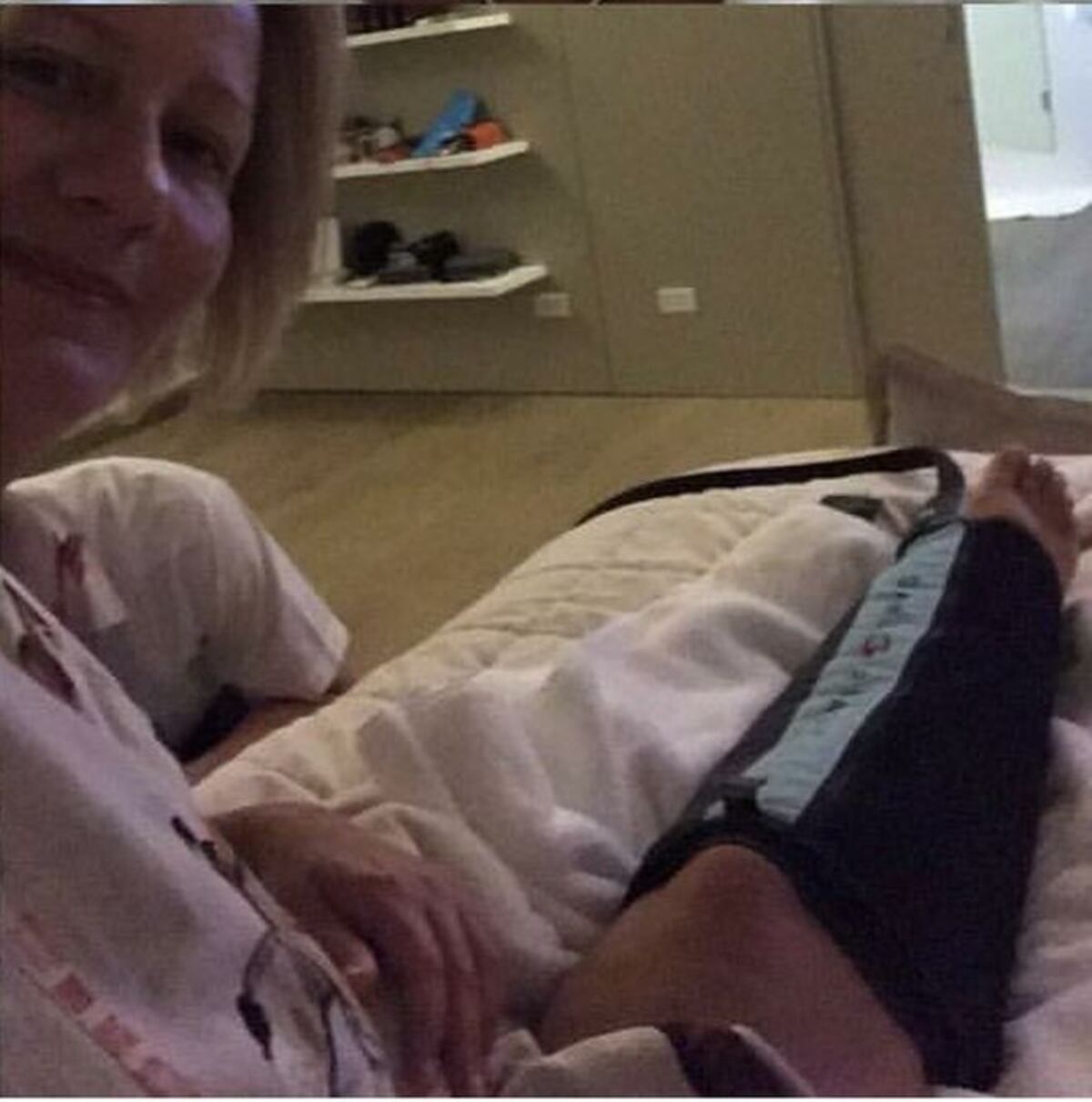 ¡AUCH! Primera Dama Lorena Castillo se lesiona una pierna