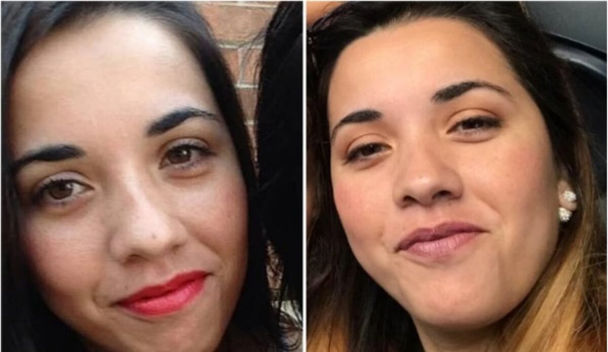 Dos pitbulls atacan y matan a su dueña en una clínica veterinaria