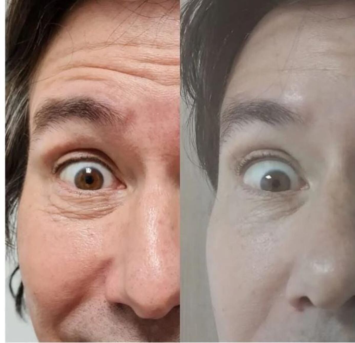 Emilio de Los Rabanes se alisa el rostro con bótox