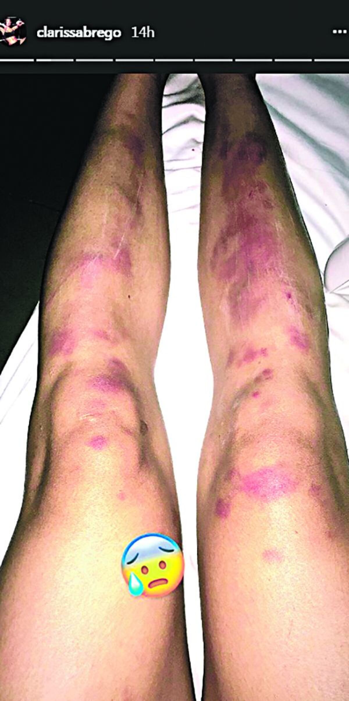 ¡BIEN GOLPEADA! Clarissa Ábrego sale de la competencia de Calle 7