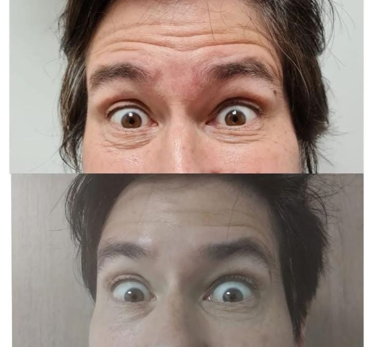 Emilio de Los Rabanes se alisa el rostro con bótox