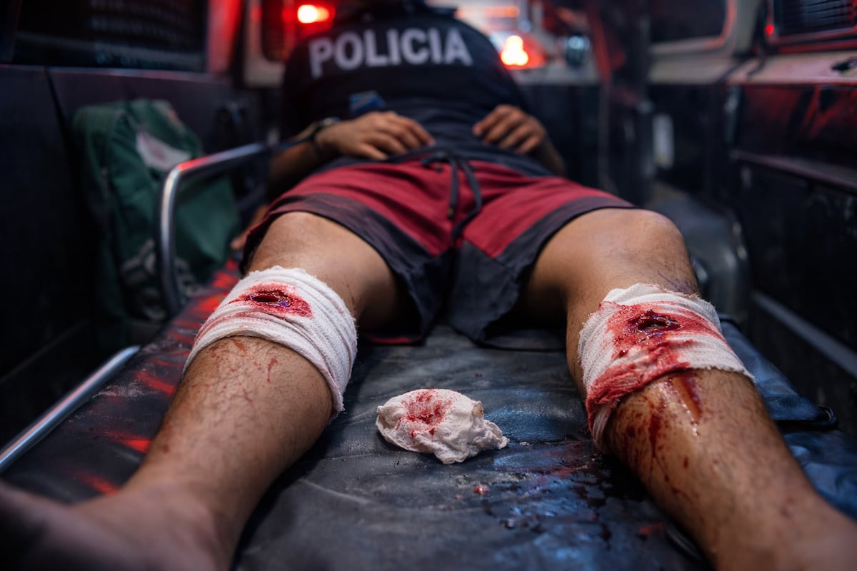 Disparos en Buena Vista dejan herido a Edwin en Buena Vista