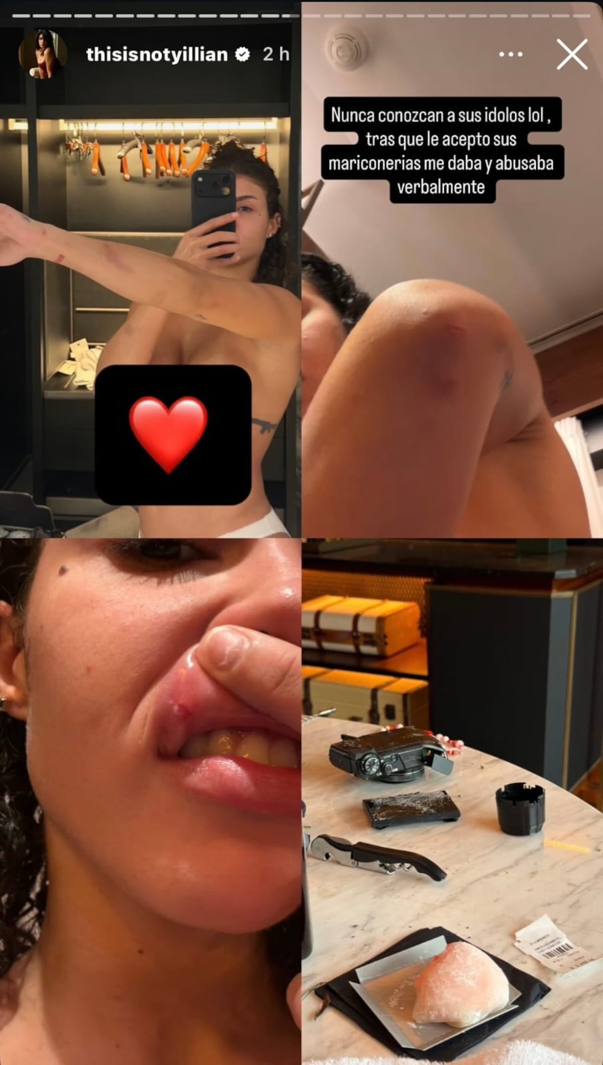 Modelo acusa a Ozuna de presunto maltrato y publica fotos que encienden las redes