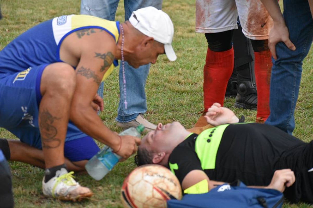Árbitro fue agredido en pleno partido por jugador que le rompió la boca