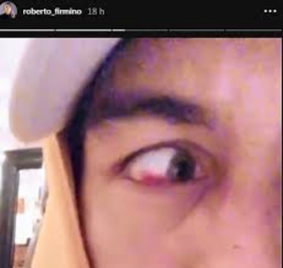 El delantero brasileño Firmino temió quedar ciego tras esta fuerte entrada