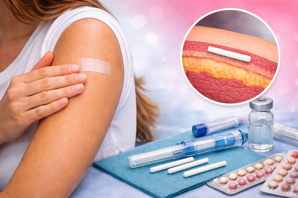 ¡Atención mujeres! Colocarán 200 implantes anticonceptivos gratis este 8 de marzo