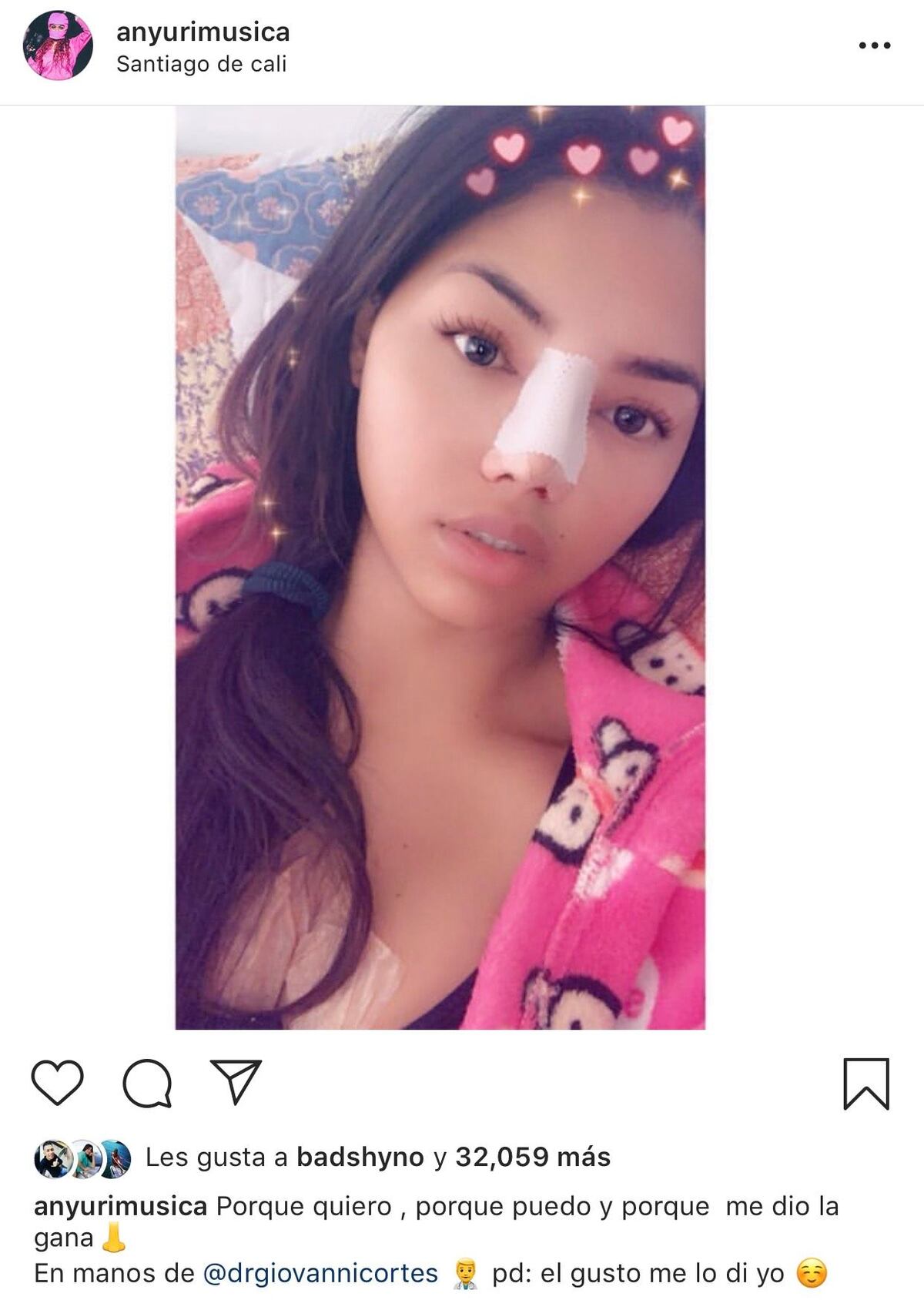 Anyuri se operó la ñata: 'Porque quiero, porque puedo y porque me dio la gana'