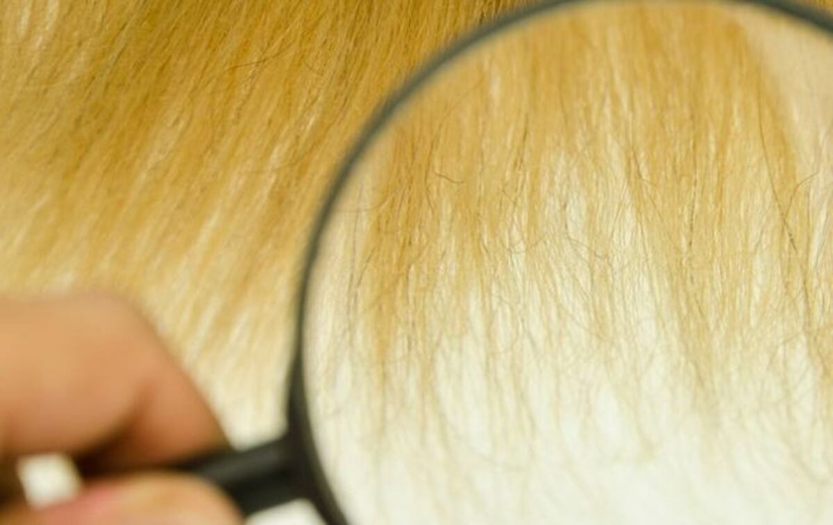 Síndrome del cabello impeinable, ¿lo podrías tener?