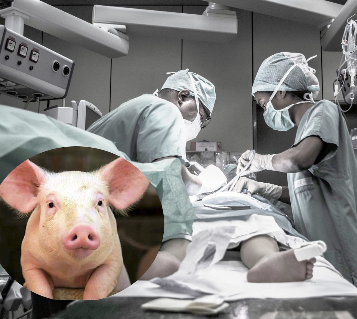 Trasplantan riñón de un cerdo modificado genéticamente a paciente de 62 años