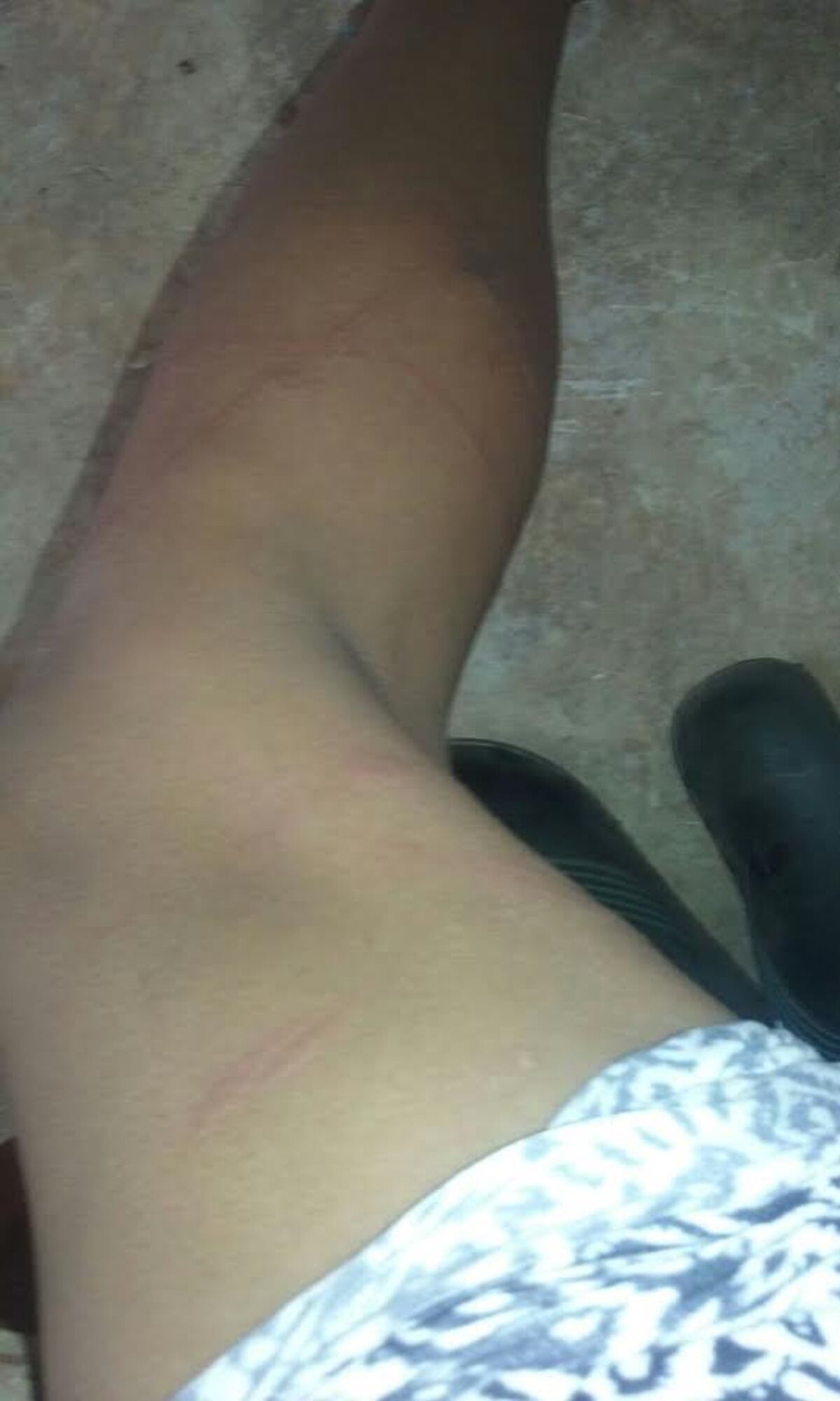 Hombre le da una cuera a su vecina con un azote para caballos en Veraguas 