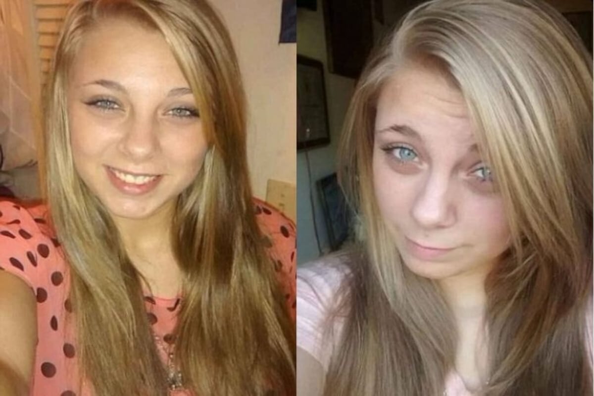 La joven que se arrancó los ojos por su adicción a la metanfetamina