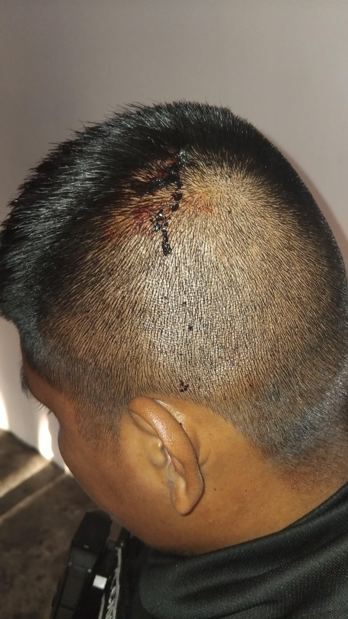 Disturbios en la 5 de Mayo: Policía Municipal resultó herido al suspender actividad bailable