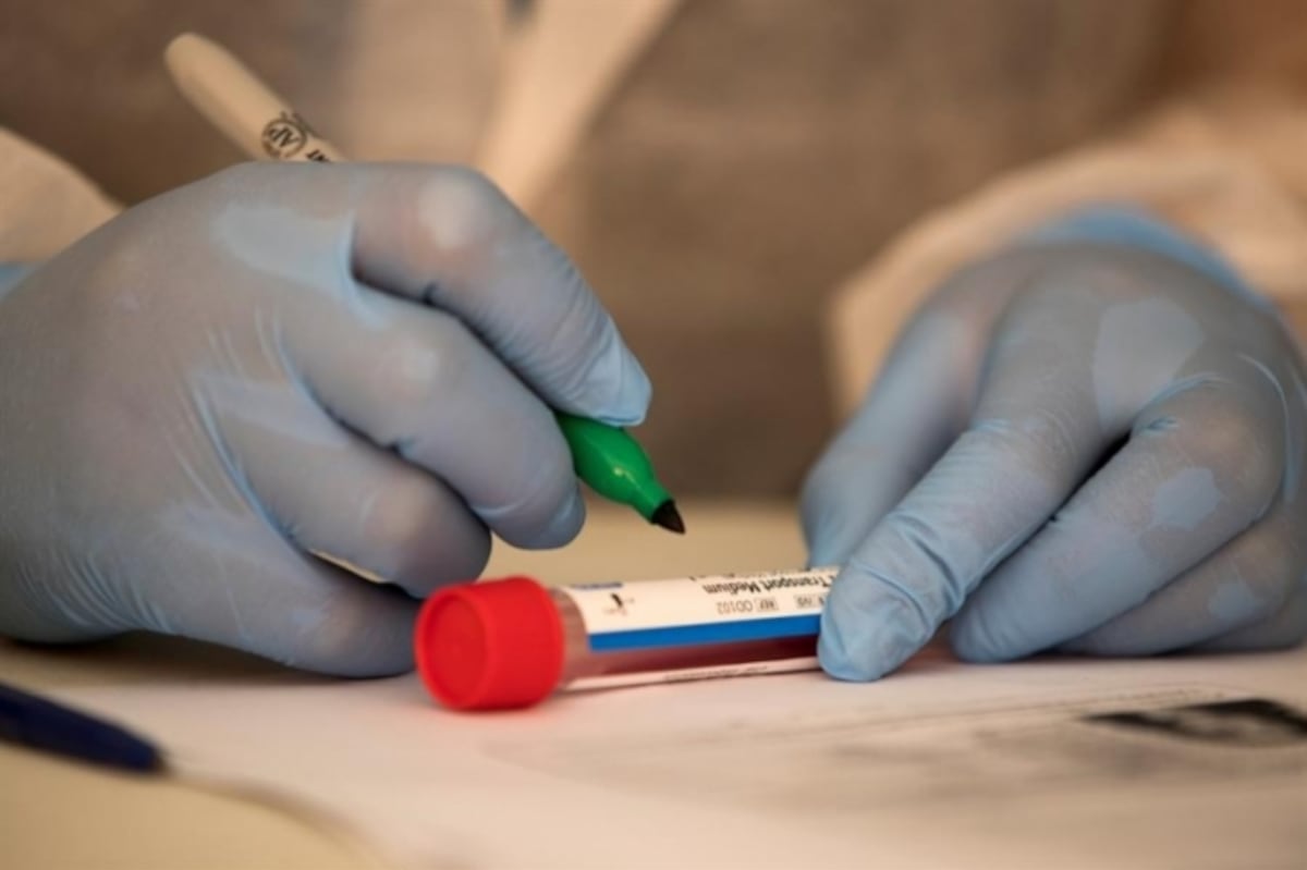 Los casos de coronavirus a nivel mundial alcanzan los 29,1 millones