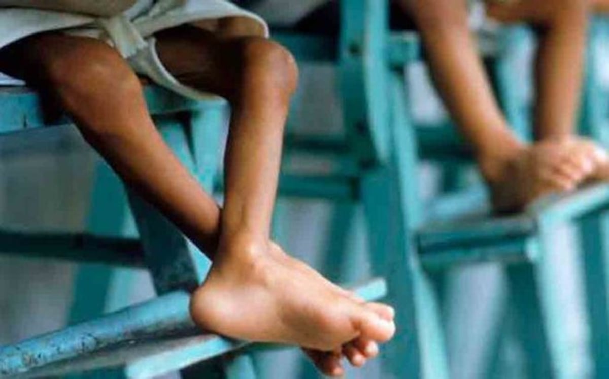 Personas que realizan dietas sin asesoría médica pueden padecer desnutrición