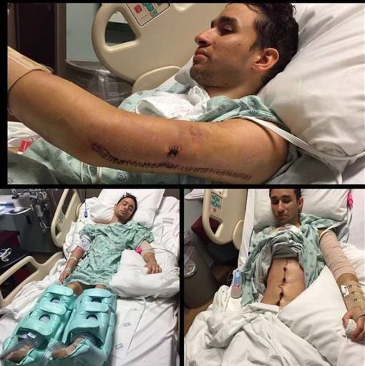 A dos años de la masacre en Pulse: Sobreviviente narra el horror que vivió