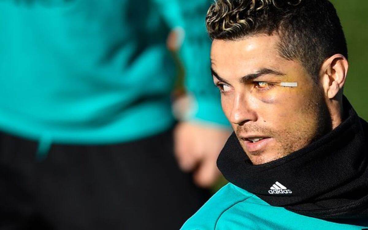 El corte en la cara de Cristiano Ronaldo pudo haber afectado su vista