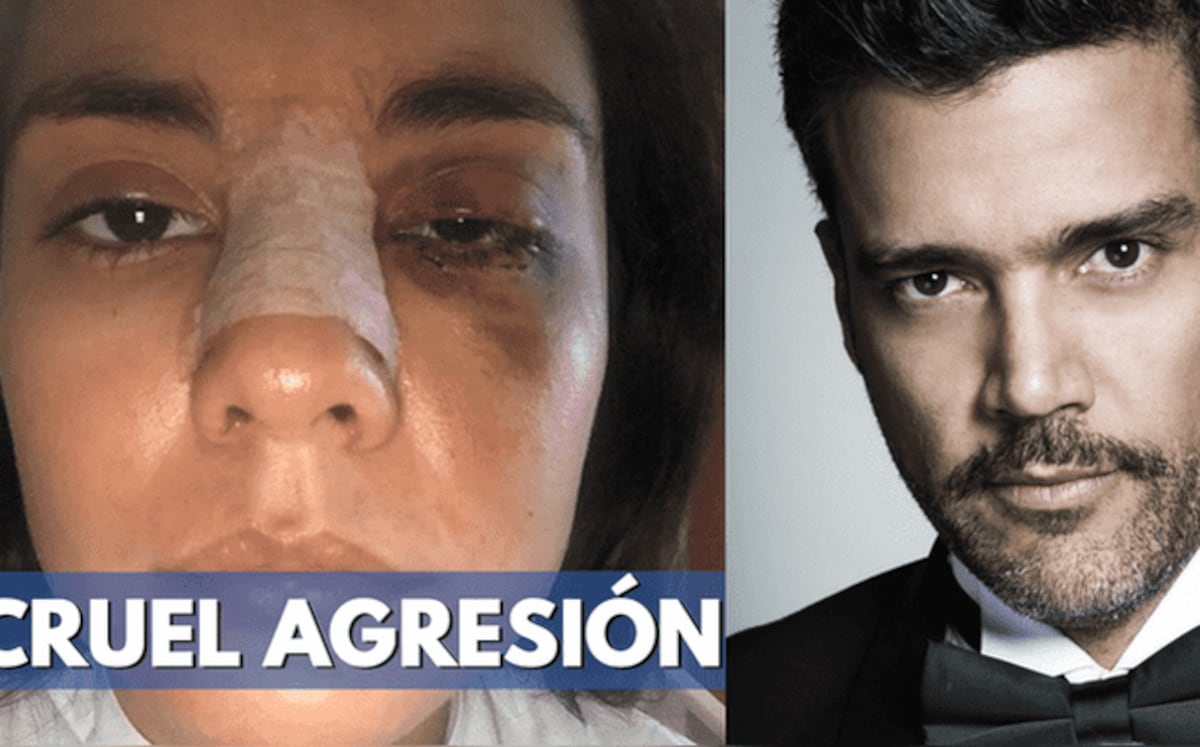 Actriz revela cómo fue la brutal golpiza que le dio actor de la 'La mamá del 10'