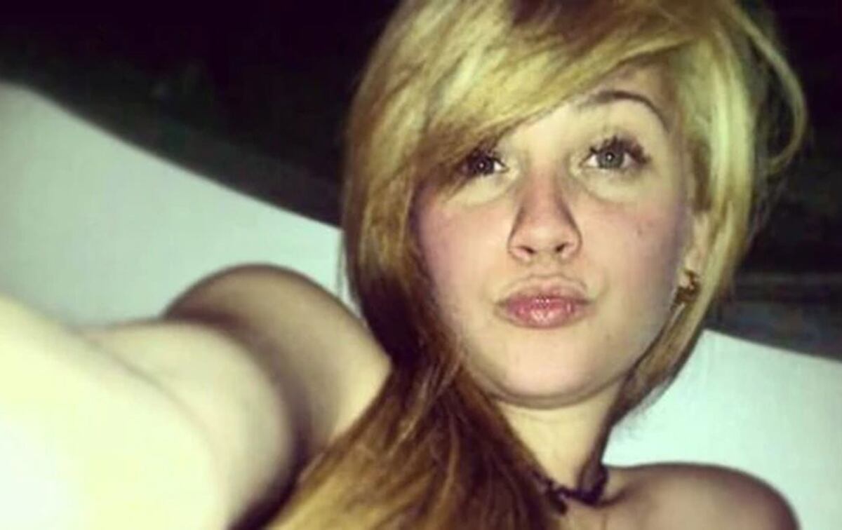 ¡DESALMADO! Venezolana fue violada, torturada y desfigurada con ácido en México