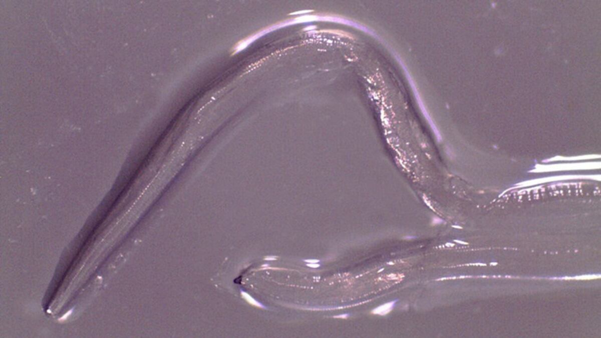 ¡AY, MI DIOS! Extraen 14 gusanos del ojo de una mujer