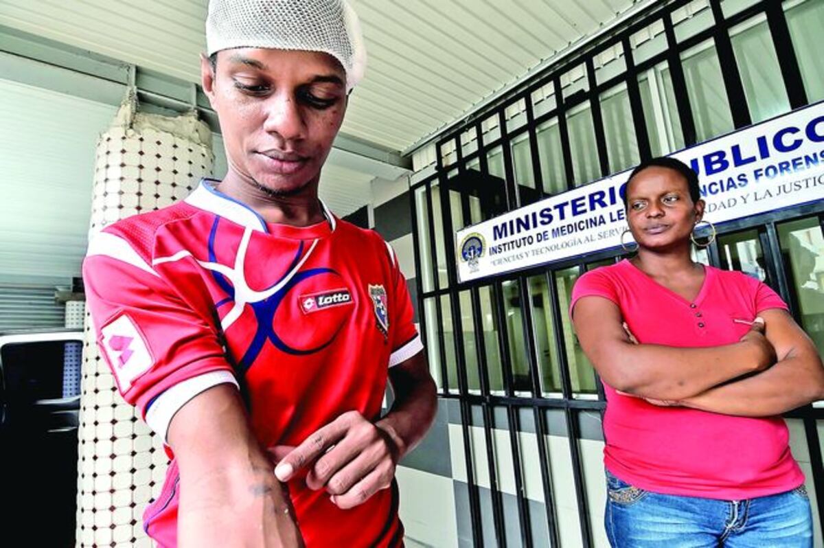 IMPACTANTE TESTIMONIO. El taxista aplastado por cisterna cuenta cómo sobrevivió