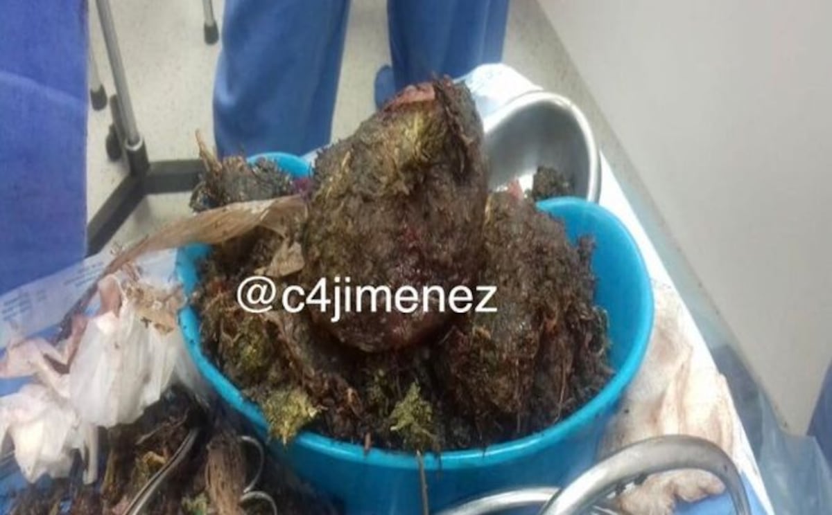 Mujer reporta un aborto  y le extraen dos kilos de droga de su vagina