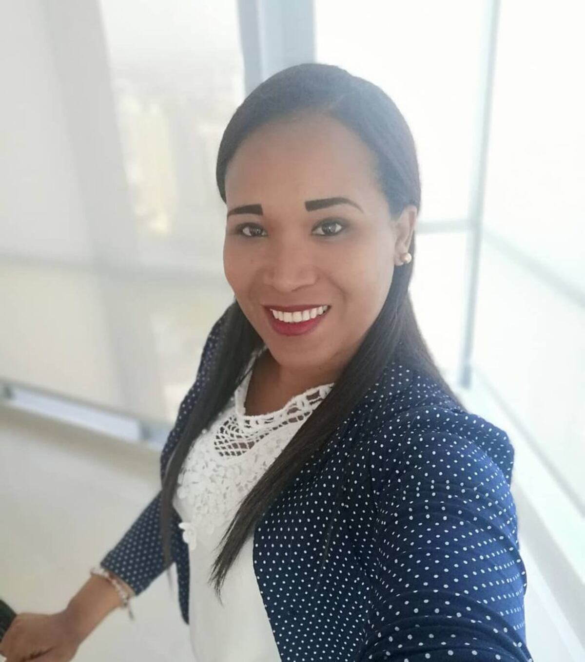 Mujer que fue atacada por el papá de sus hijas en Arraiján recibió quemaduras en el 60% de su cuerpo 