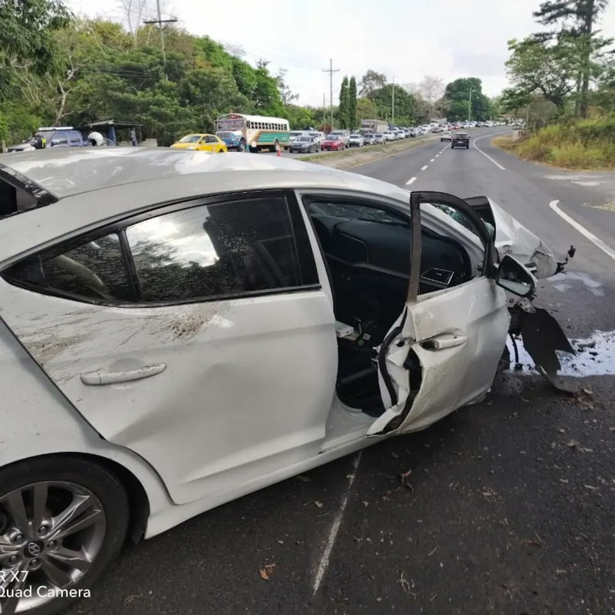 Impactante. Choque fatal contra un árbol. Conductor sale expulsado del auto y queda en el pavimento. Video