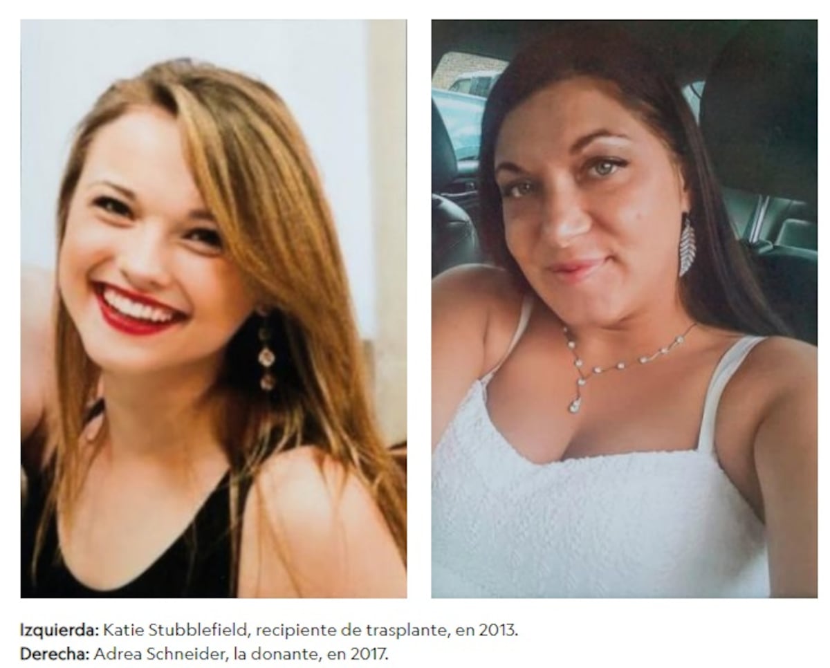 Una joven se disparó en la cara y recibe un trasplante de rostro