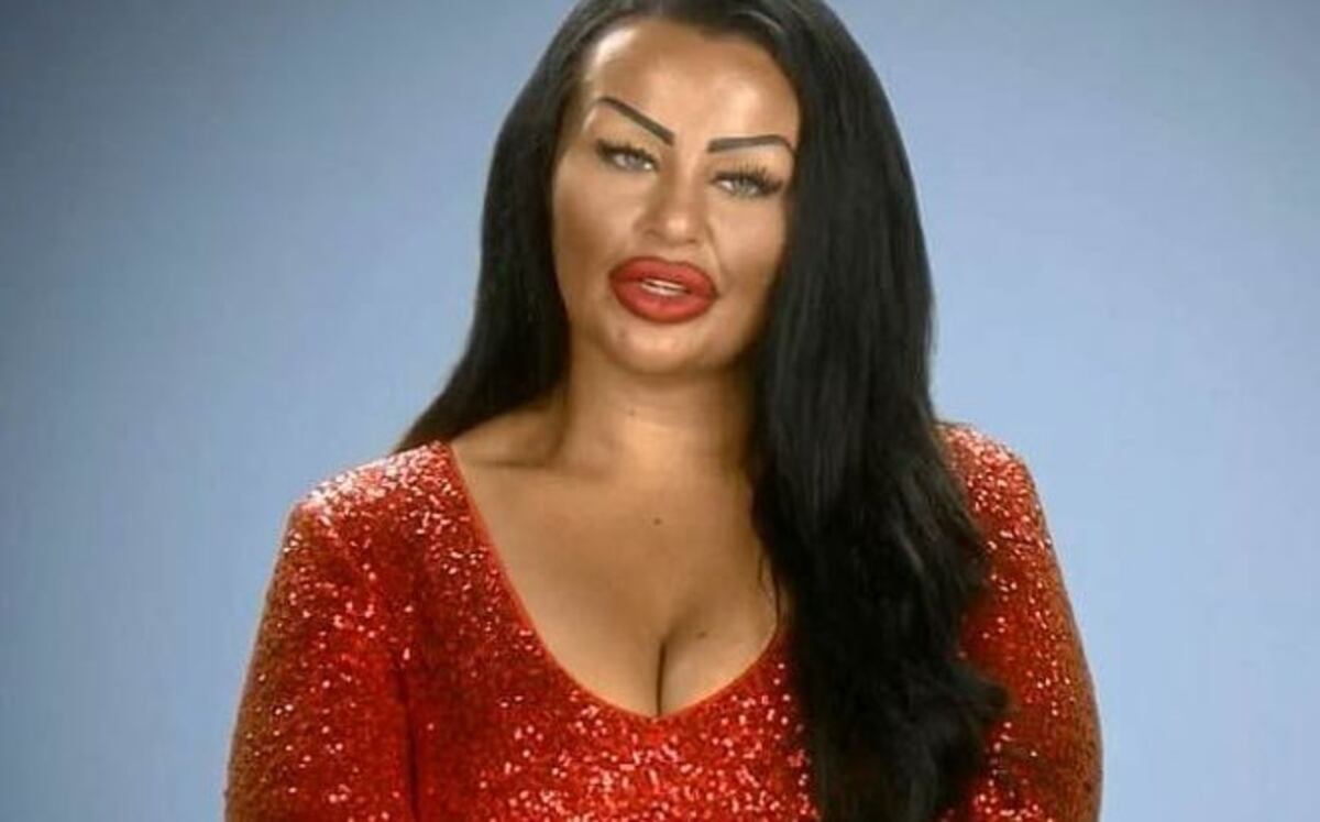 Se operó los pezones para tenerlos en forma de corazón,el resultado no fue bueno