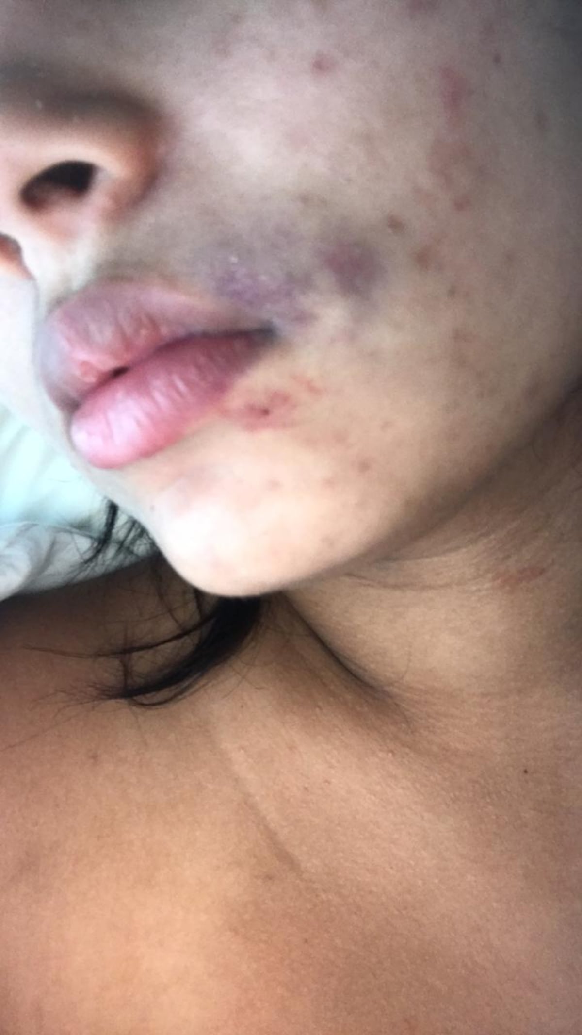 Yemil podría volver a la cárcel. Presuntamente volvió a agredir a otra chica