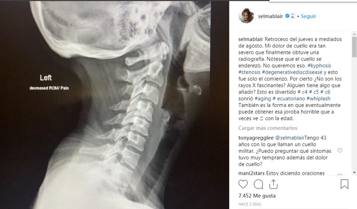 La actriz hollywodense Selma Blair revela que padece una terrible enfermedad