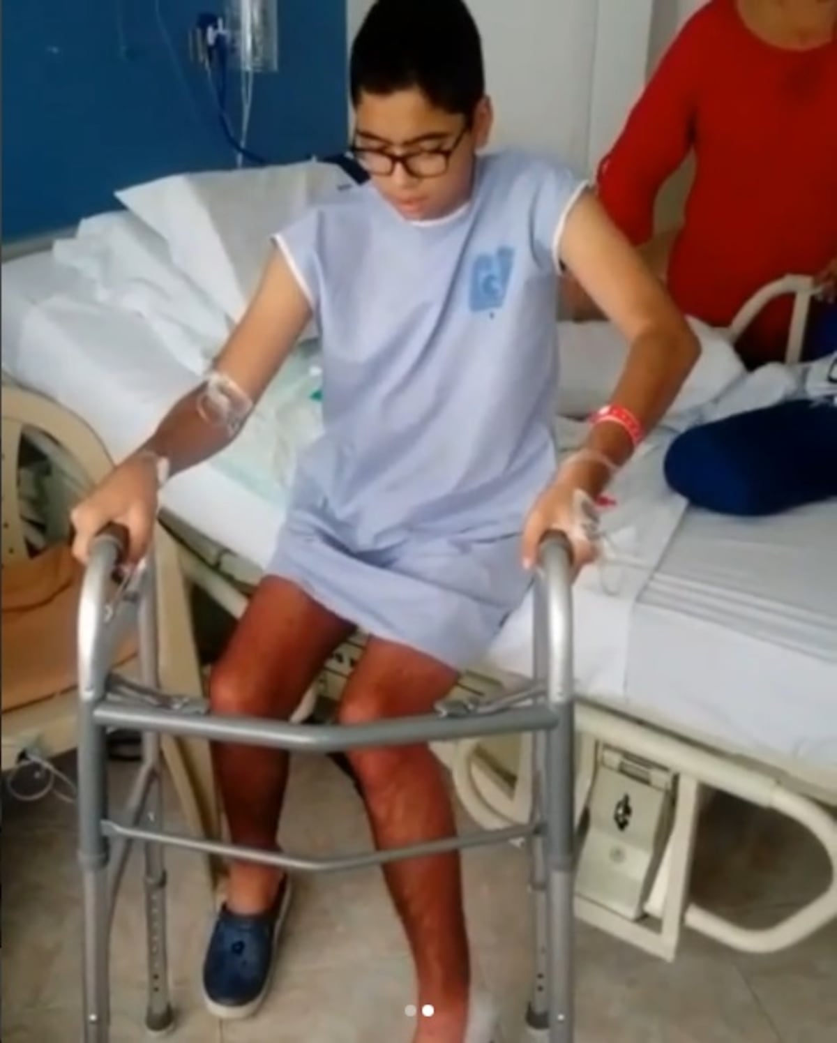 ¡QUÉ EMOCIÓN! Carlos Alberto ya da sus primeros pasos con su nueva cadera