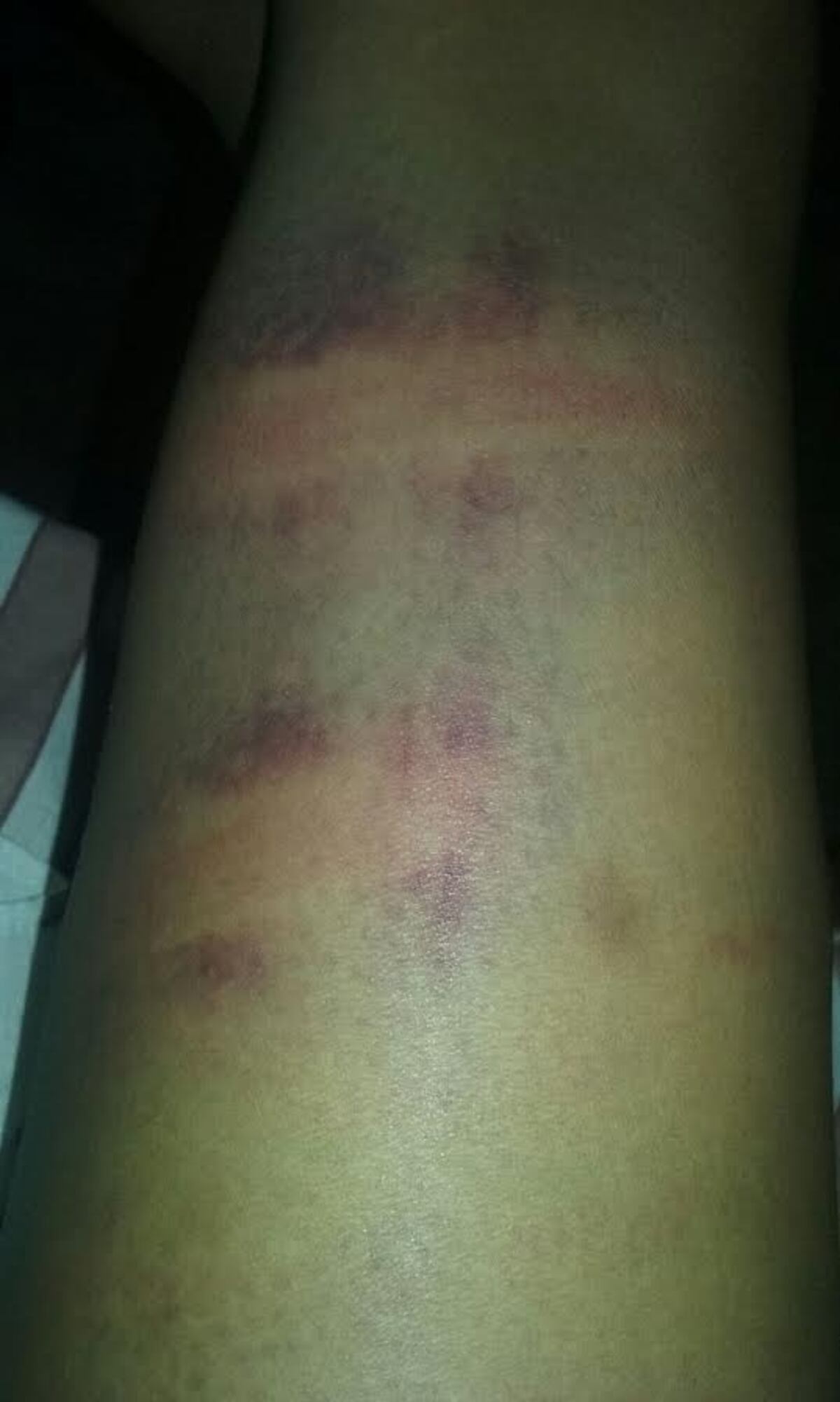 Hombre le da una cuera a su vecina con un azote para caballos en Veraguas 