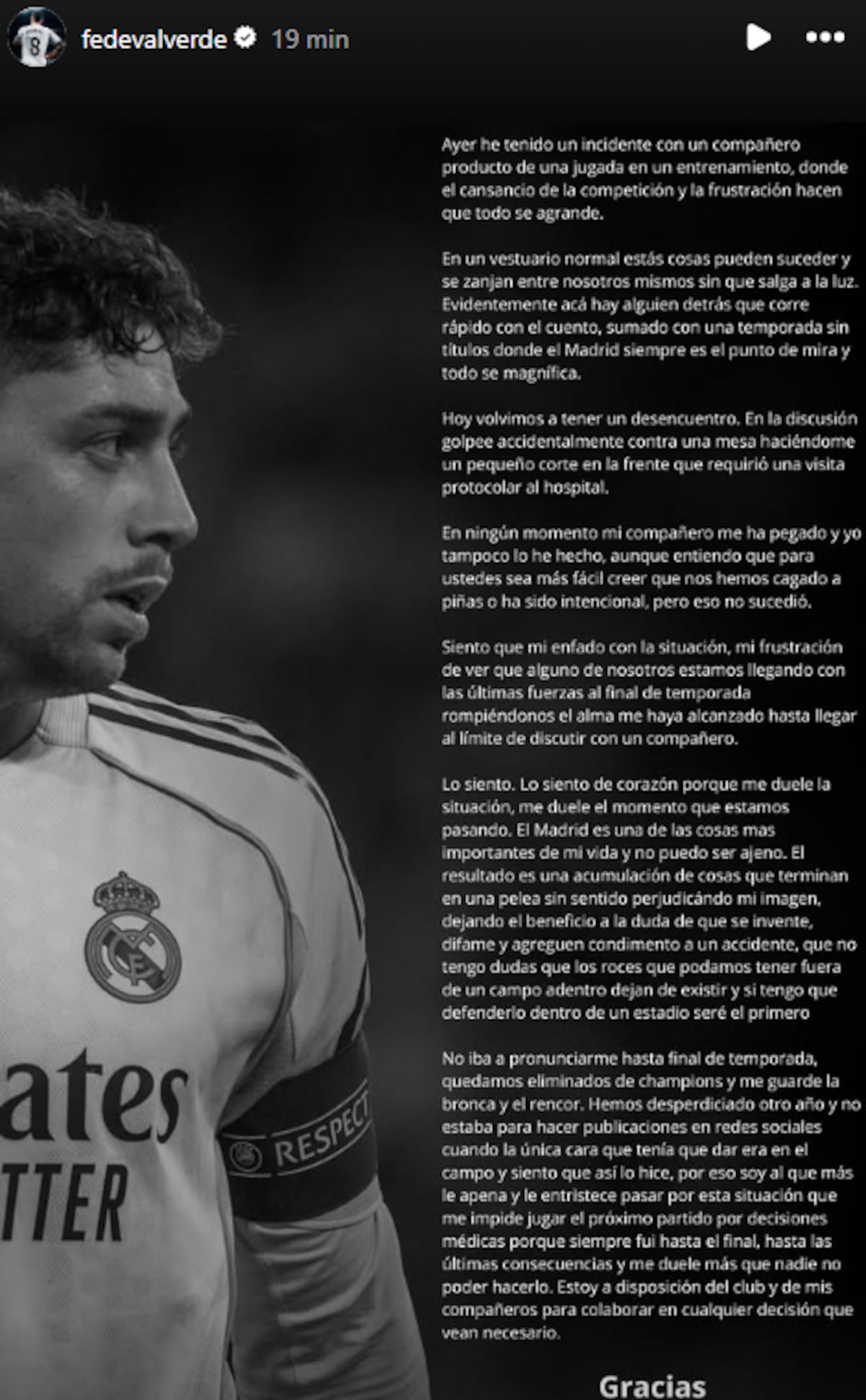 ‘Lo siento de verdad’: Valverde habla tras pelea con Tchouaméni