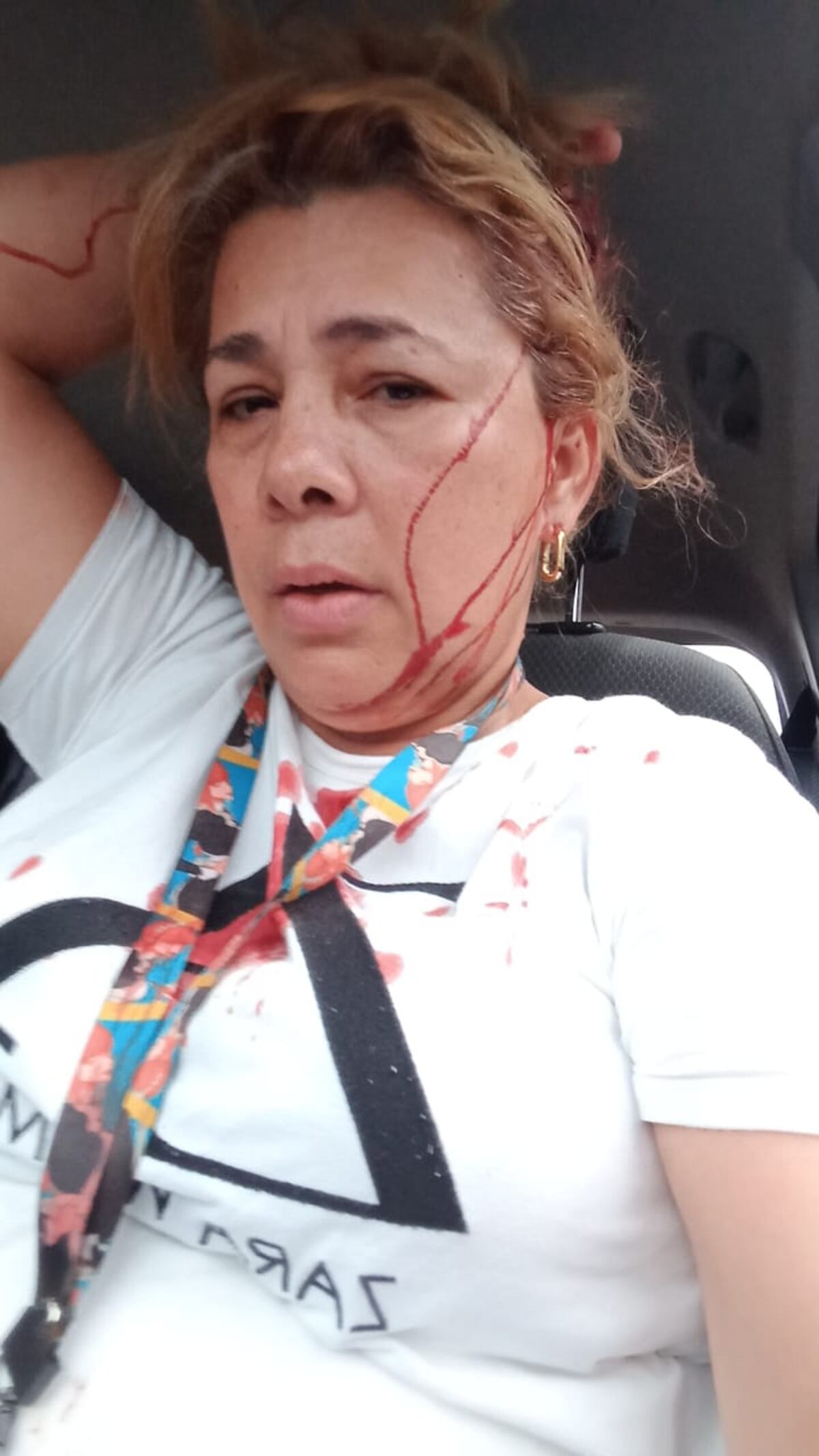 URGENTE: Atacan a machetazos y piedras a directora del INADEH en Changuinola