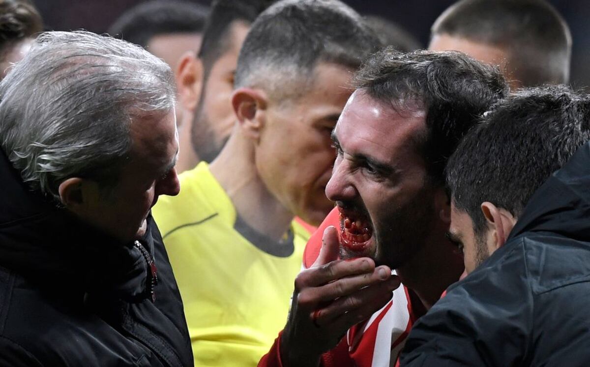 Diego Godín: 'Entiendan que no puedo sonreír mucho'