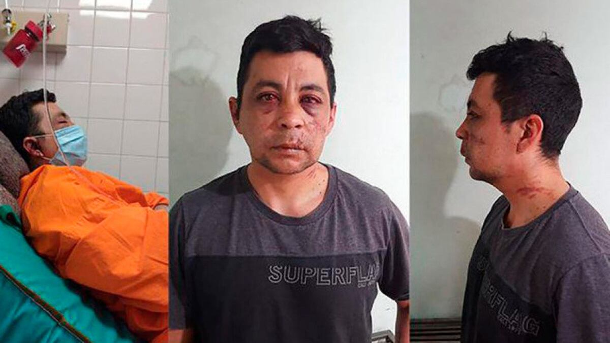 Roban, golpean y le incendian la casa a un enfermero argentino que tuvo covid-19 para obligarlo a que abandone el barrio