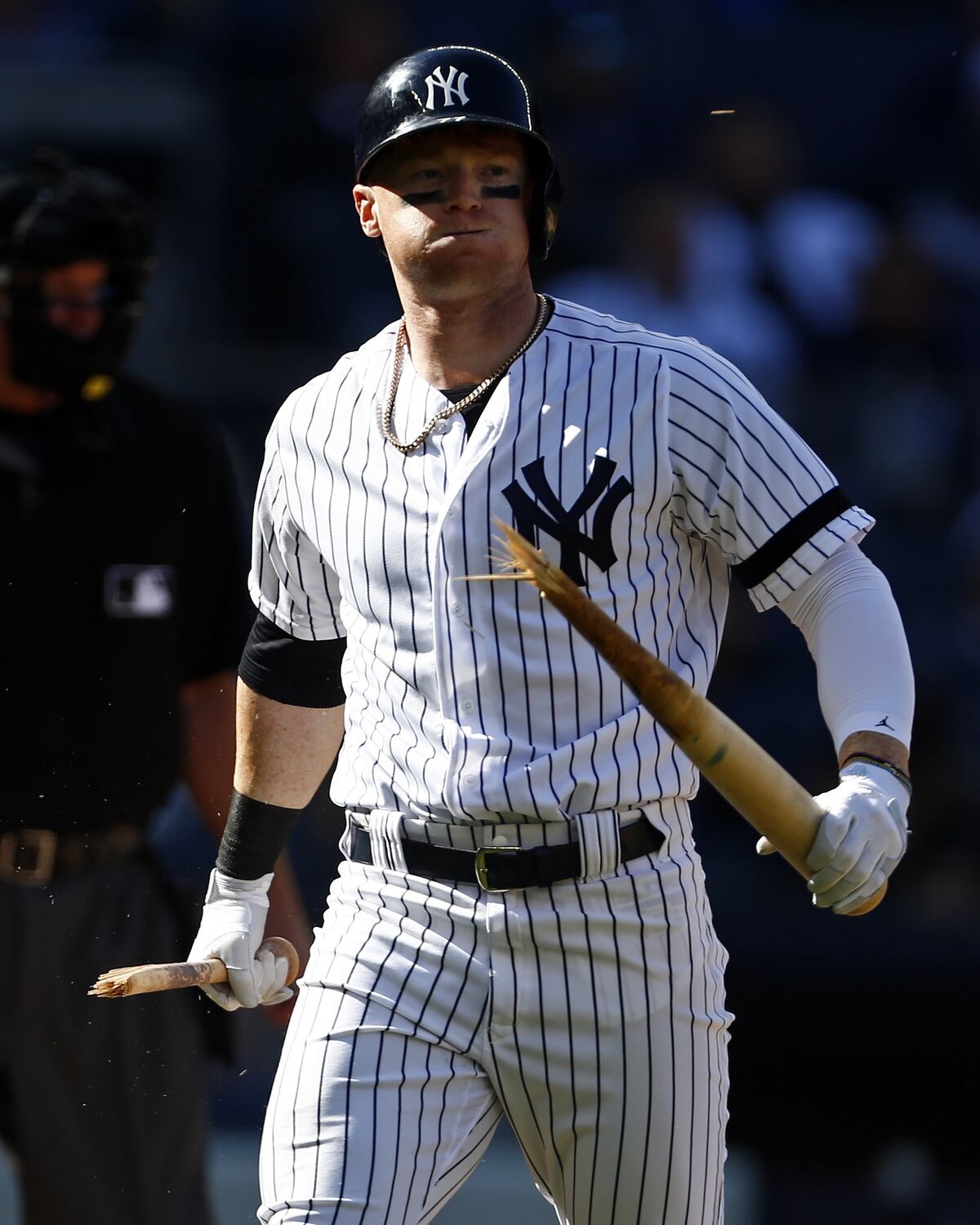 Otro más que se suma al hospital de los Yankees